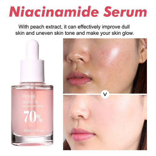 Niacinamide Facial Serum