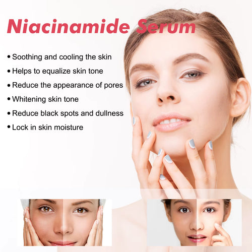 Niacinamide Facial Serum